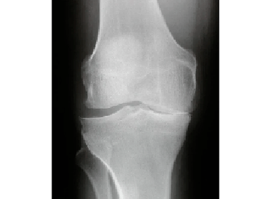 Diagnosis of the joints of the knee joint