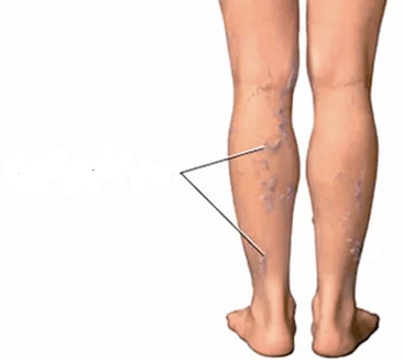 The joint consequences of the knee