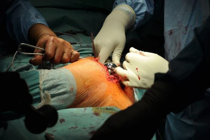 Surgery