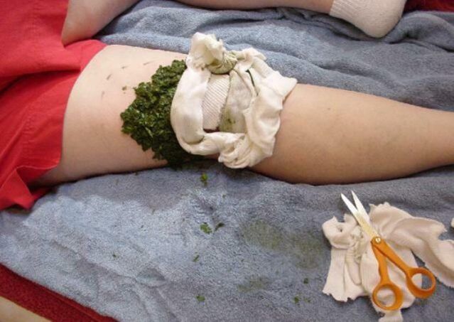 poultice for arthrosis of the knee joint