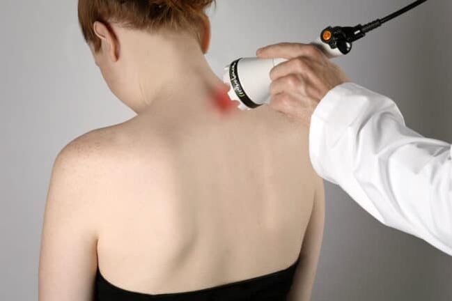 Laser therapy is used to treat back pain in the shoulder blade area. 